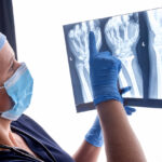 AI to assist doctors in detecting broken bones in X-rays